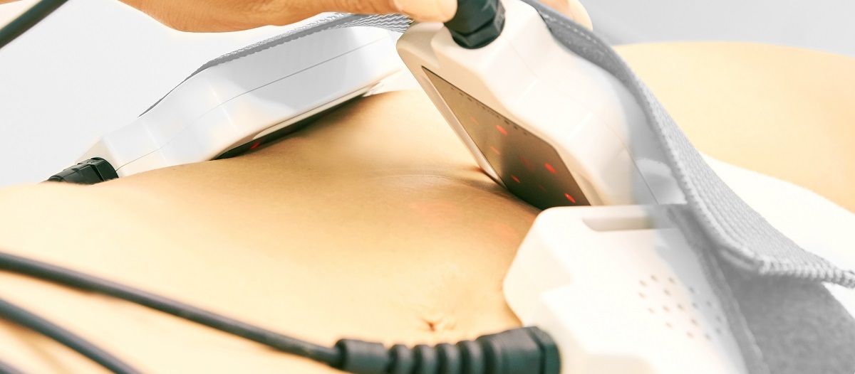 Cómo funciona el láser lipolítico y cuáles son sus beneficios