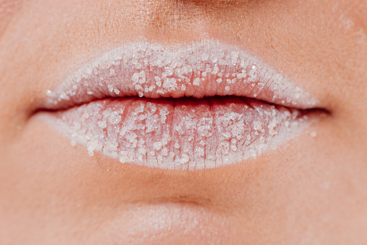 ¿Tienes puntos blancos en los labios? Te explicamos qué son