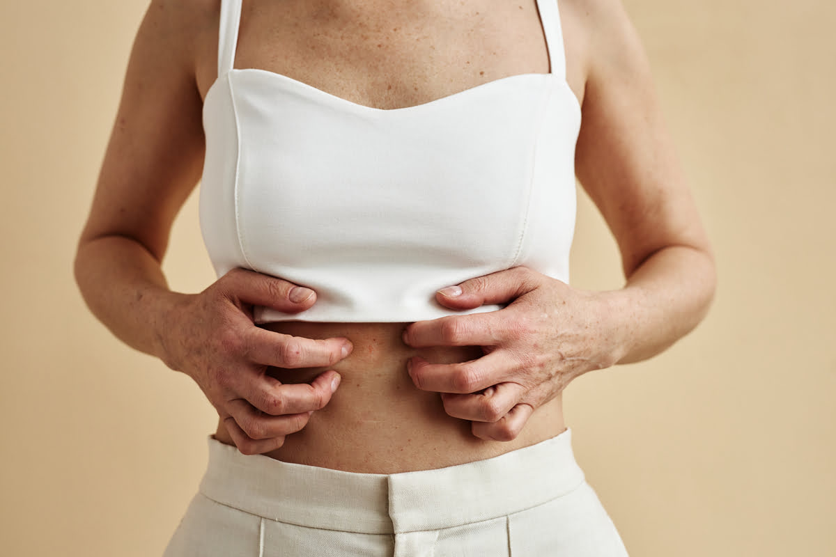 7 alimentos prohibidos si tienes psoriasis