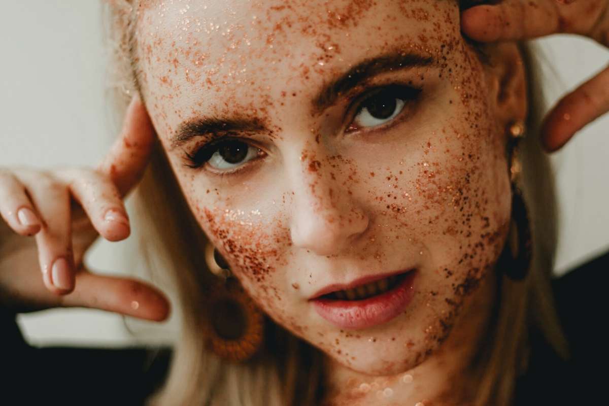 Explotar los granos con pus, ¿Sí o no?